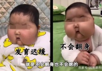 5个月的女婴用了抗菌膏变成“大头娃娃”？漳州市卫生健康委员会:已立案调查。